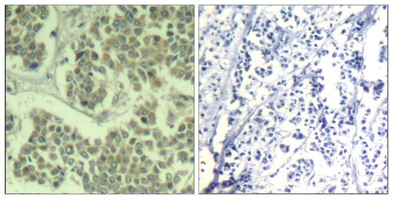 Rabbit anti-Phospho-eIF2α(Ser49) Polyclonal Antibody