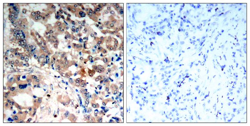 Rabbit anti-Phospho-AMPKα1/AMPKα2(Thr183/Thr172) Polyclonal Antibody