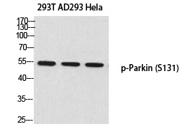 Rabbit anti-Phospho-Parkin(Ser131) Polyclonal Antibody