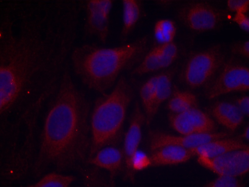 Rabbit anti-Phospho-NFκB p105/p50(Ser893) Polyclonal Antibody