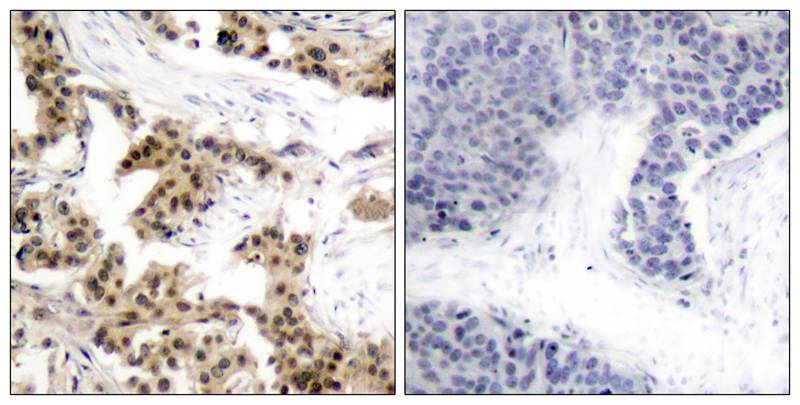 Rabbit anti-Phospho-NFκB p105/p50(Ser893) Polyclonal Antibody