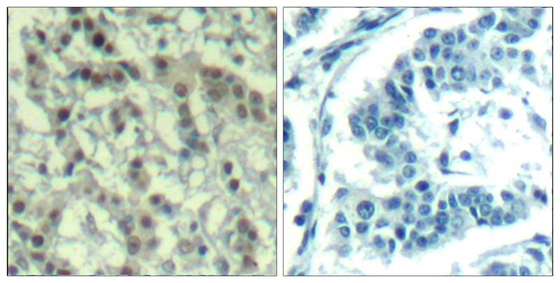 Rabbit anti-Phospho-Aurora A(Thr288) Polyclonal Antibody