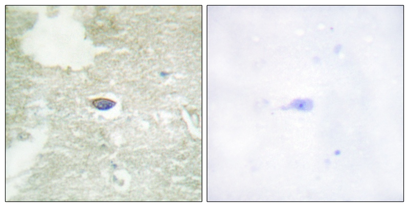 Rabbit anti-Phospho-TGF-β Receptor II(Ser225/250) Polyclonal Antibody