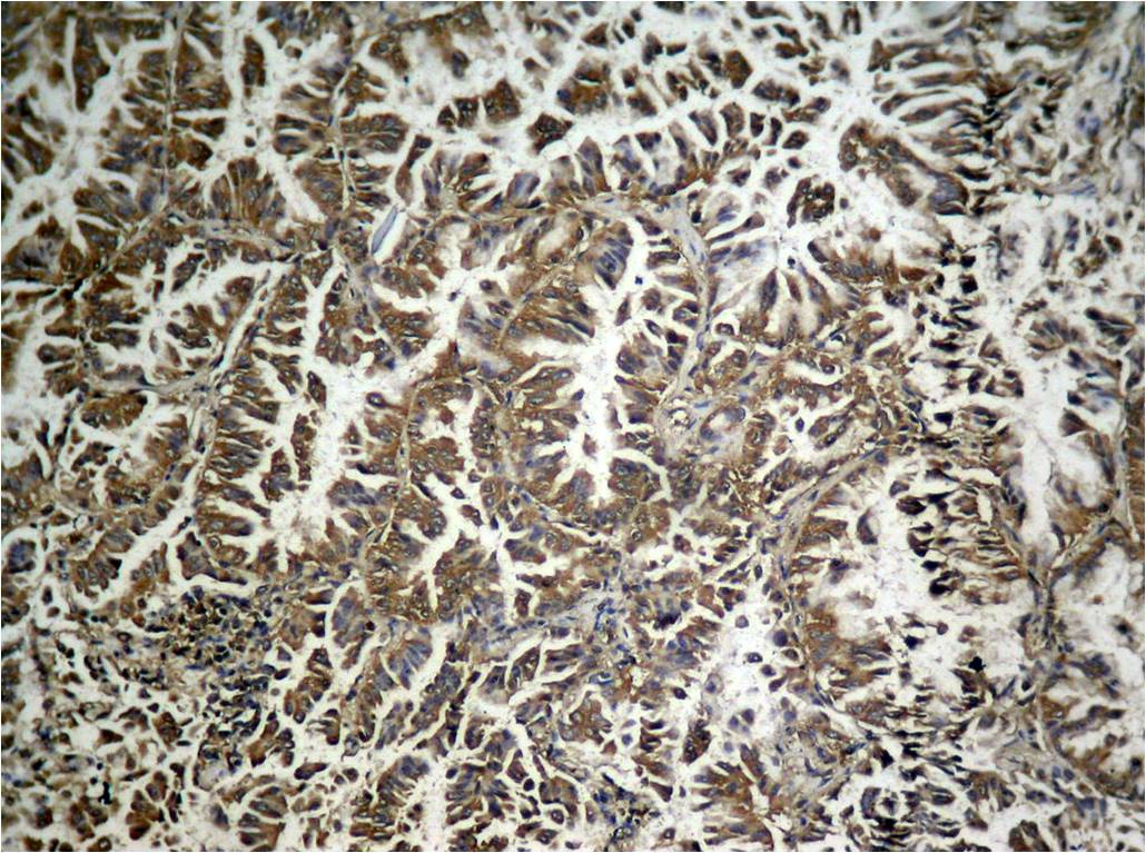 Rabbit anti-Phospho-eIF2α(Ser49) Polyclonal Antibody