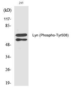 Rabbit anti-Phospho-Lyn(Tyr508) Polyclonal Antibody