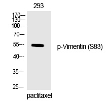 Rabbit anti-Phospho-Vimentin(Ser83) Polyclonal Antibody