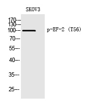 Rabbit anti-Phospho-EF-2(Thr56) Polyclonal Antibody