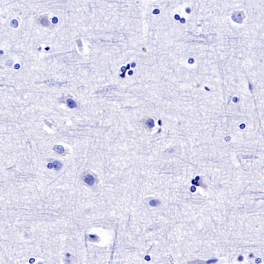 Rabbit IgG Isotype Control(S-240-1)