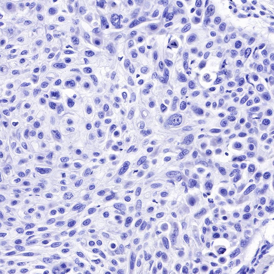 Rabbit anti-CK8/18 Recombinant Monoclonal Antibody(P005)