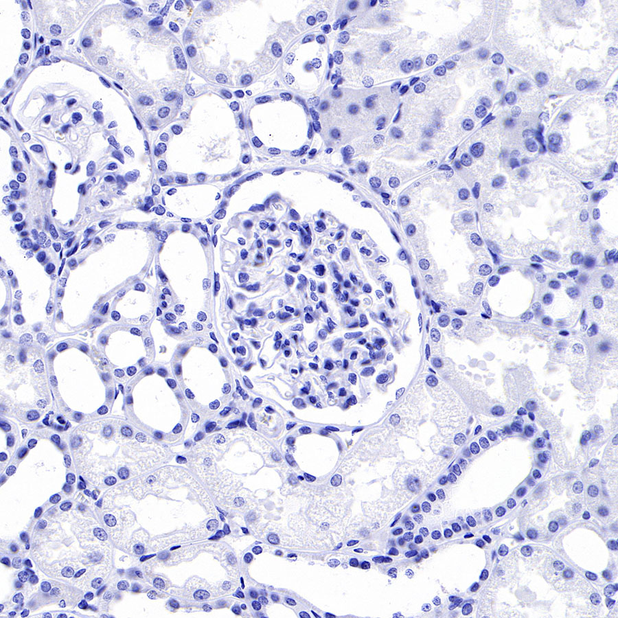 Rabbit IgG Isotype Control(S-240-1)