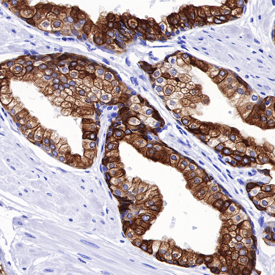 Rabbit anti-CK8/18 Recombinant Monoclonal Antibody(P005)