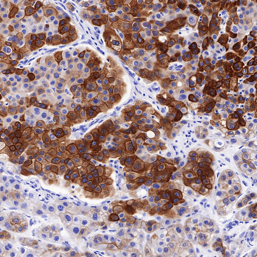 Rabbit anti-CK8/18 Recombinant Monoclonal Antibody(P005)