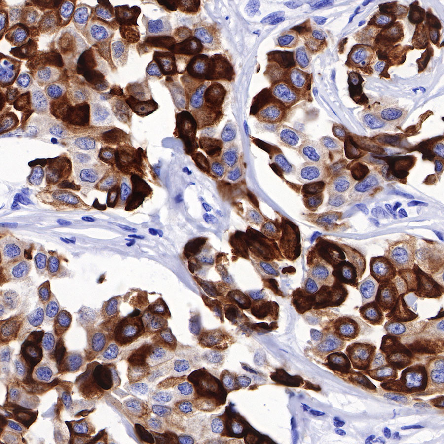 Rabbit anti-CK8/18 Recombinant Monoclonal Antibody(P005)