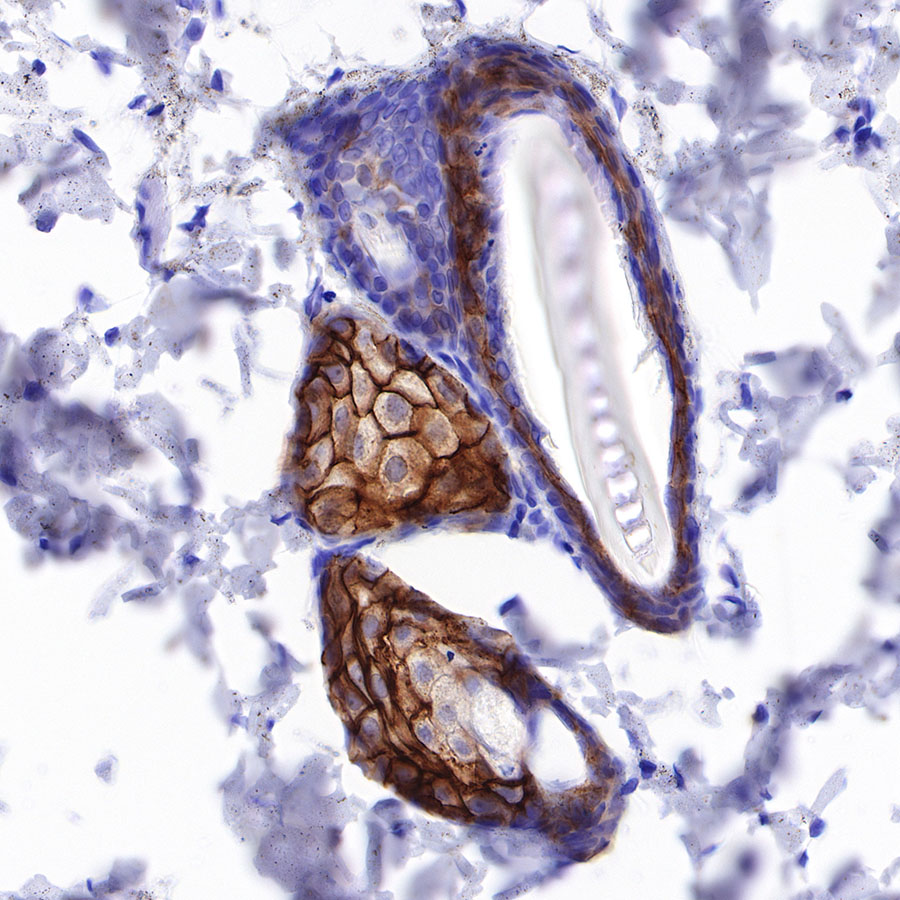 Rabbit anti-TACSTD2 Recombinant Monoclonal Antibody(S-R237)