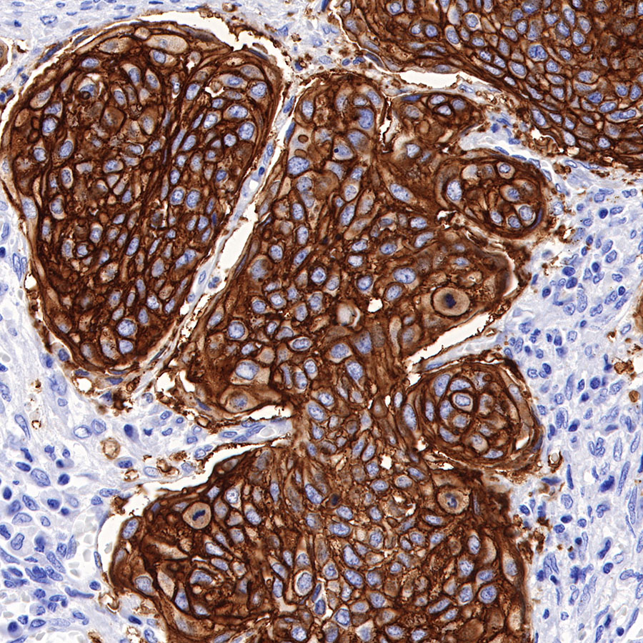 Rabbit anti-TACSTD2 Recombinant Monoclonal Antibody(S-R237)