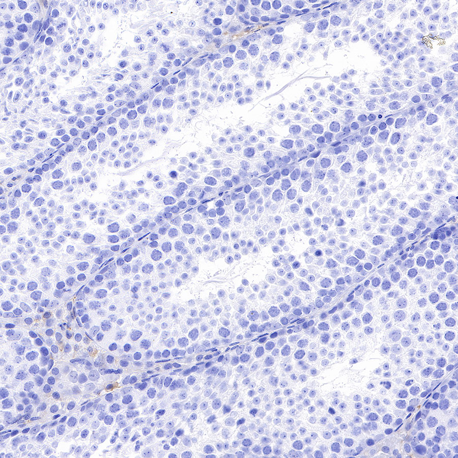 Rabbit anti-α-Synuclein Recombinant Monoclonal Antibody(S-441-86)
