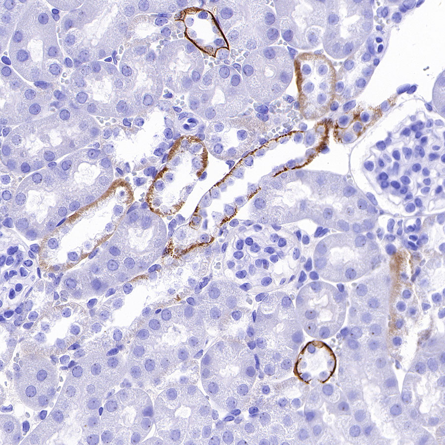 Rabbit anti-TACSTD2 Recombinant Monoclonal Antibody(S-R237)
