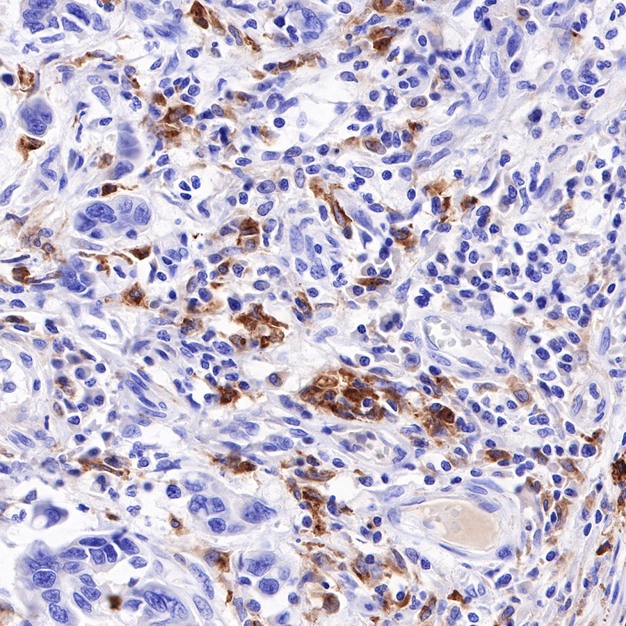 Rabbit anti-GPNMB Recombinant Monoclonal Antibody(S-R241)
