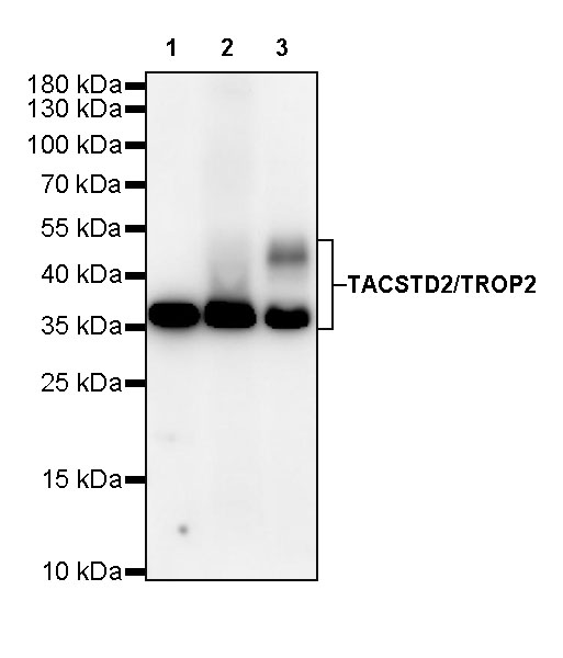 Rabbit anti-TACSTD2 Recombinant Monoclonal Antibody(S-R237)