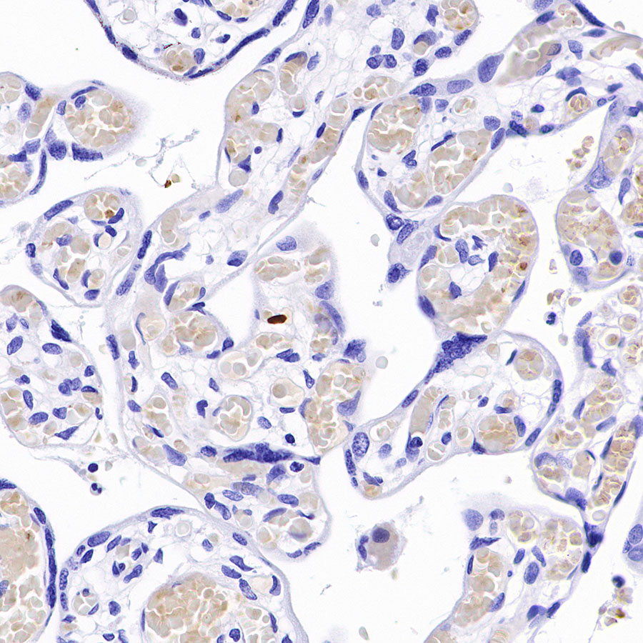Rabbit anti-Hemoglobin α Recombinant Monoclonal Antibody(S-R242)