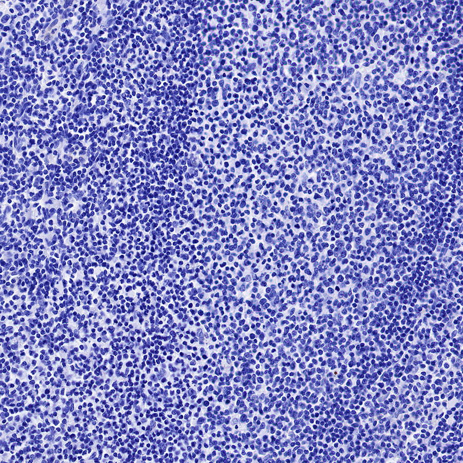 Rabbit anti-α-Synuclein Recombinant Monoclonal Antibody(S-441-86)