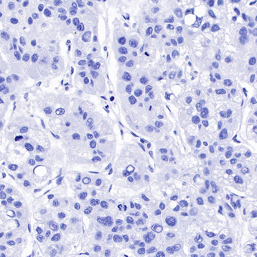 Rabbit anti-CA125 Recombinant Monoclonal Antibody(555-41)