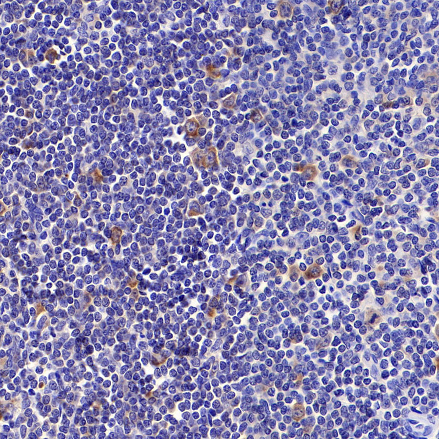 Rabbit anti-Hemoglobin α Recombinant Monoclonal Antibody(S-R242)