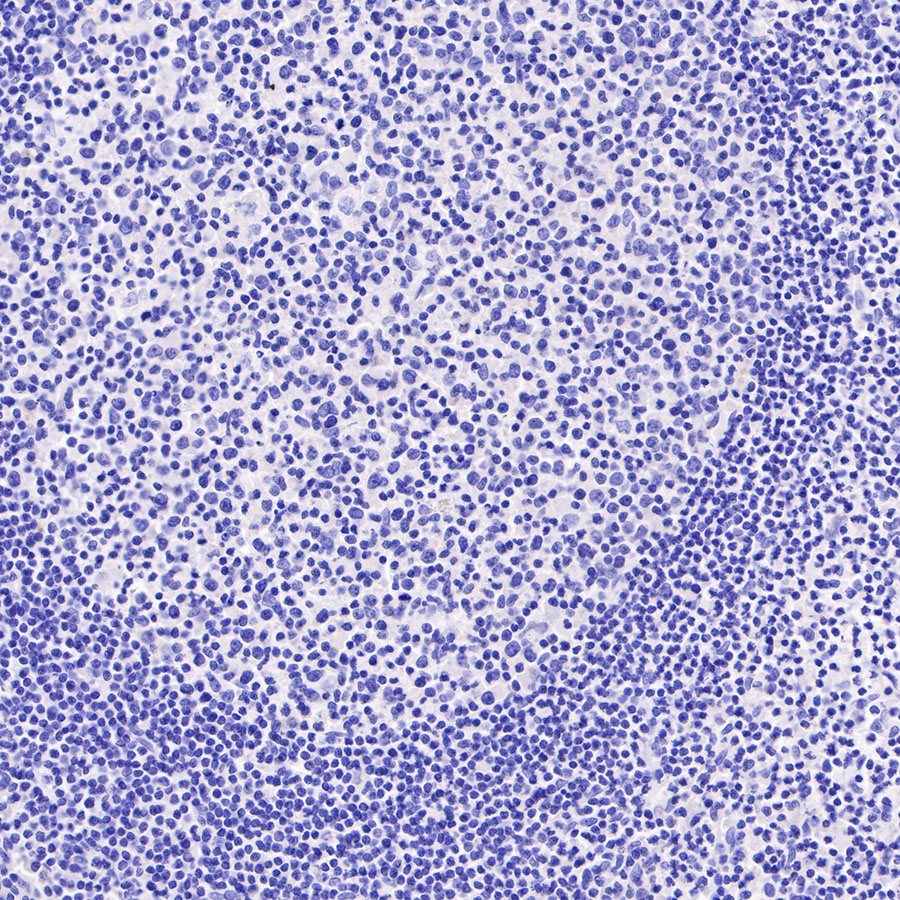 Rabbit anti-Dystrophin Recombinant Monoclonal Antibody(S-090-327)