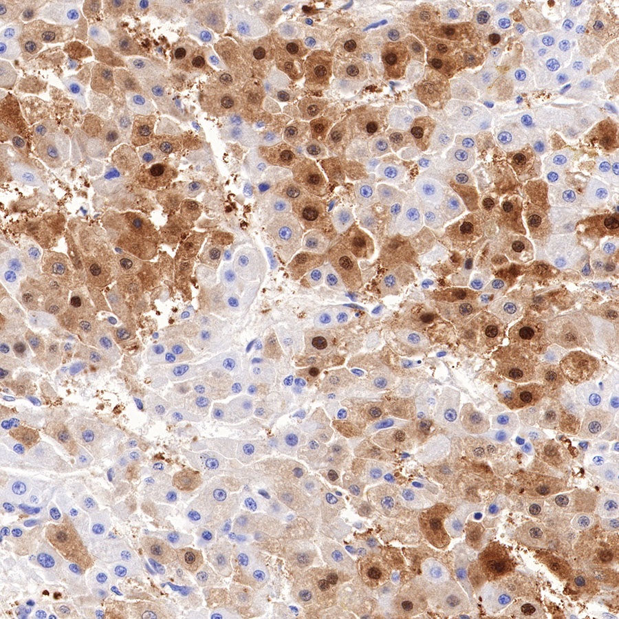 Rabbit anti-Arginase-1 Recombinant Monoclonal Antibody(369-33)