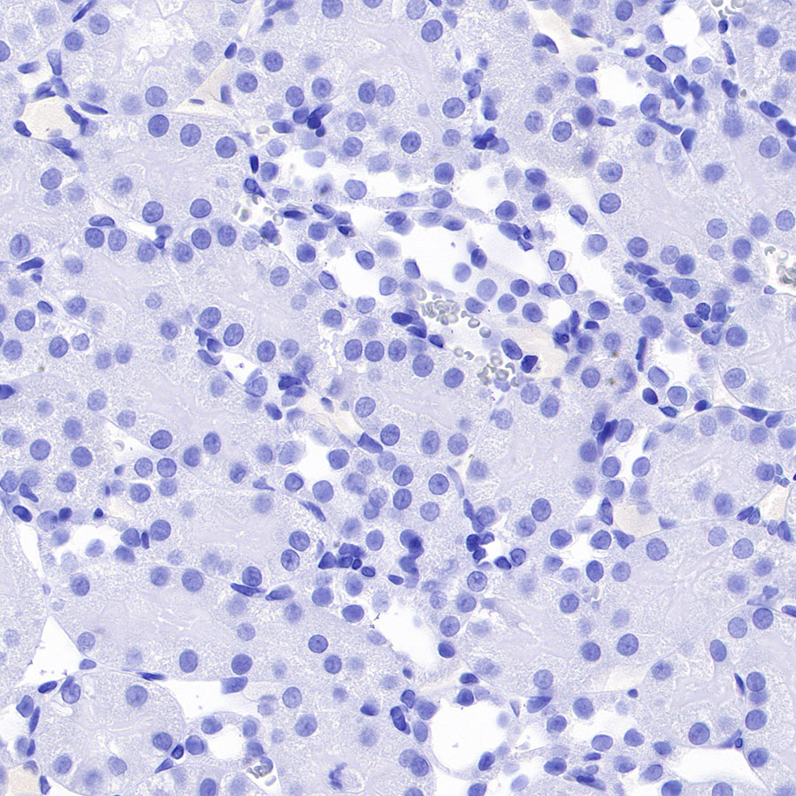 Rabbit anti-α-Synuclein Recombinant Monoclonal Antibody(S-441-86)