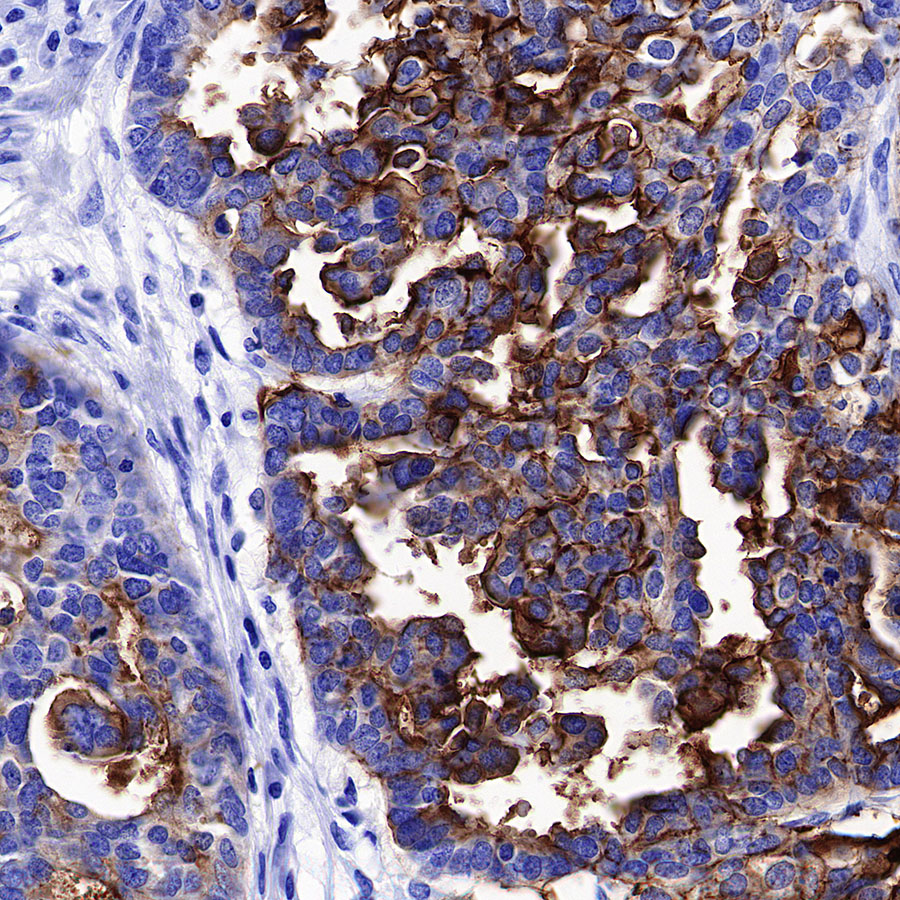 Rabbit anti-CA125 Recombinant Monoclonal Antibody(555-41)