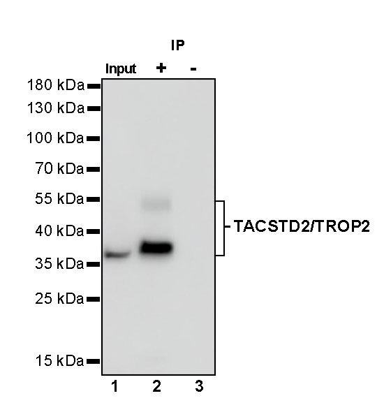 Rabbit anti-TACSTD2 Recombinant Monoclonal Antibody(S-R237)
