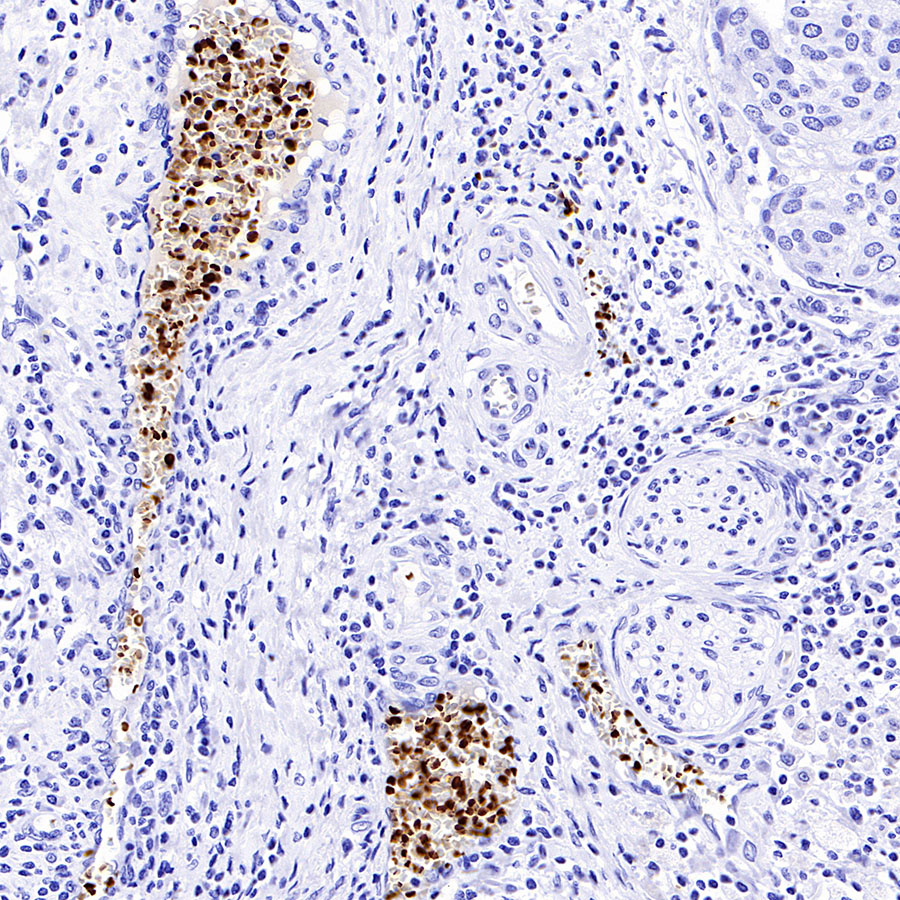 Rabbit anti-Hemoglobin α Recombinant Monoclonal Antibody(S-R242)