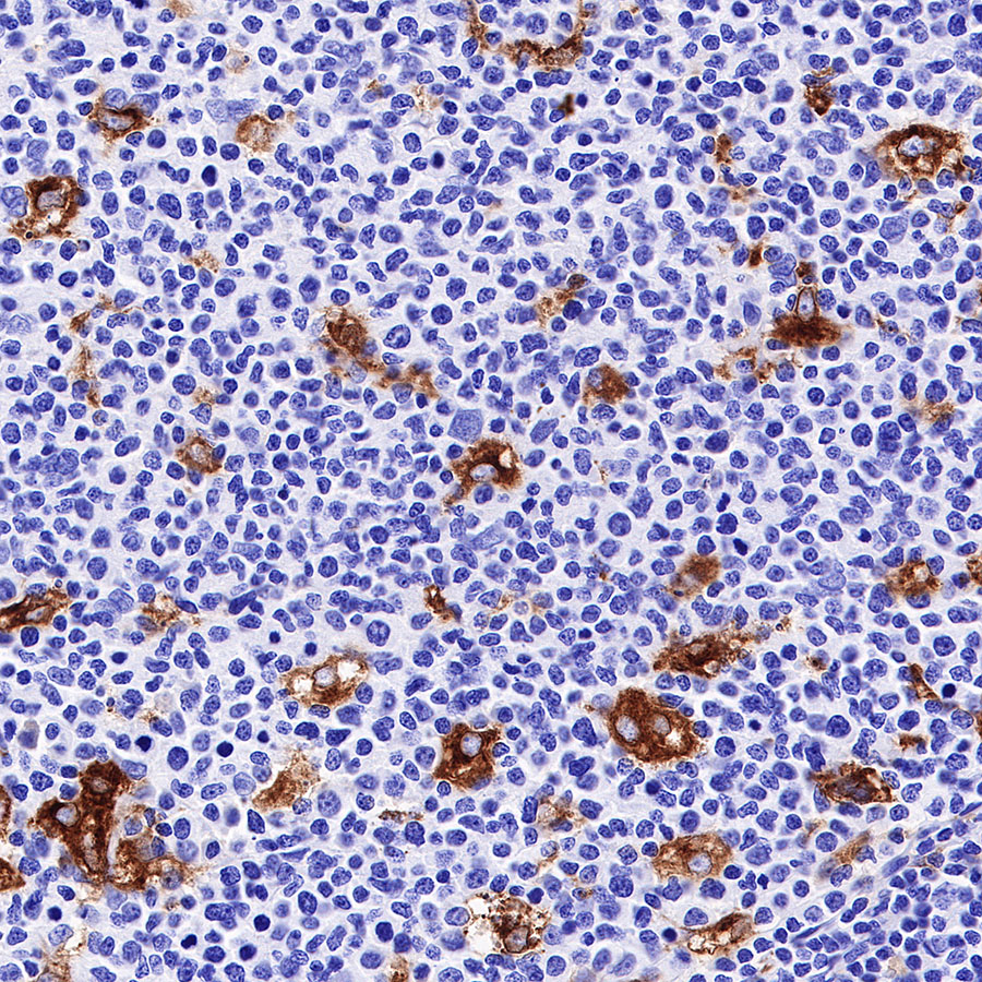 Rabbit anti-GPNMB Recombinant Monoclonal Antibody(S-R241)