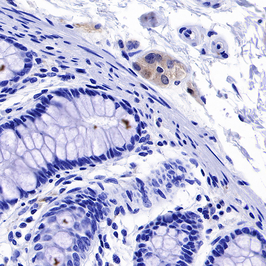 Rabbit anti-α-Synuclein Recombinant Monoclonal Antibody(S-441-86)