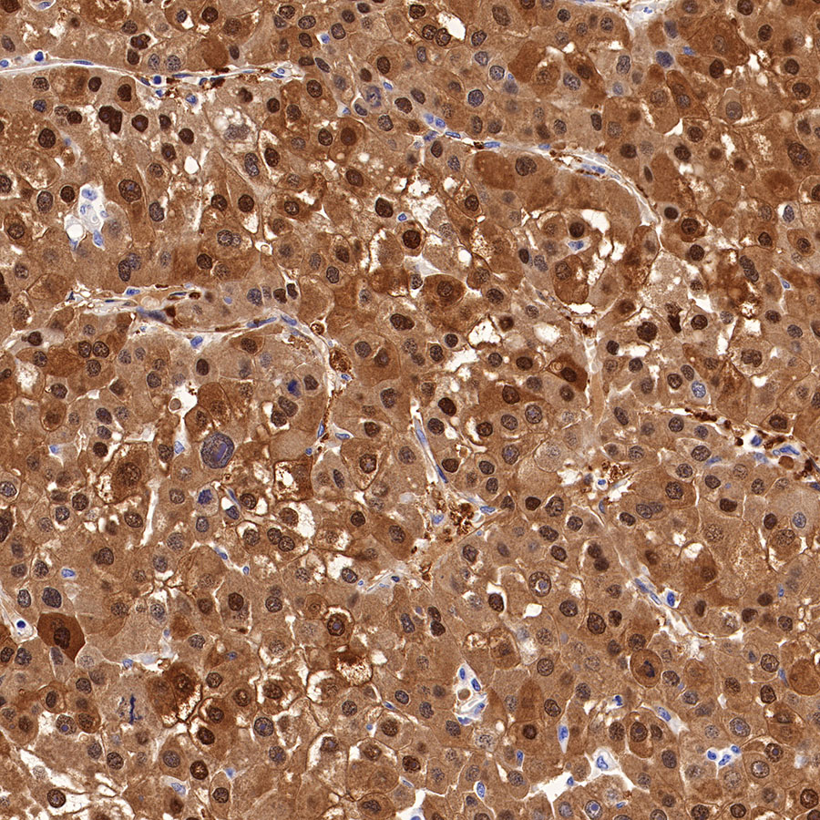 Rabbit anti-Arginase-1 Recombinant Monoclonal Antibody(369-33)