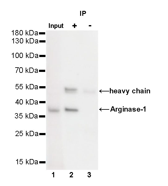 Rabbit anti-Arginase-1 Recombinant Monoclonal Antibody(369-33)