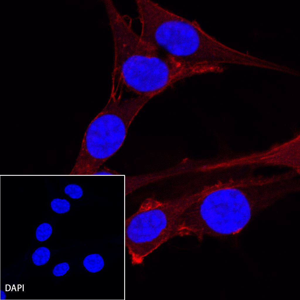Rabbit anti-β-Actin Recombinant Monoclonal Antibody(AF594 Conjugate)(S-R156)