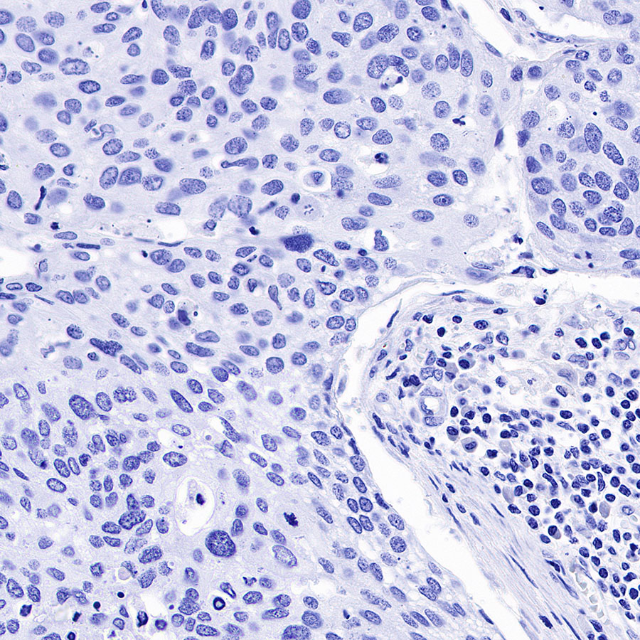 Rabbit anti-α-Synuclein Recombinant Monoclonal Antibody(S-441-86)