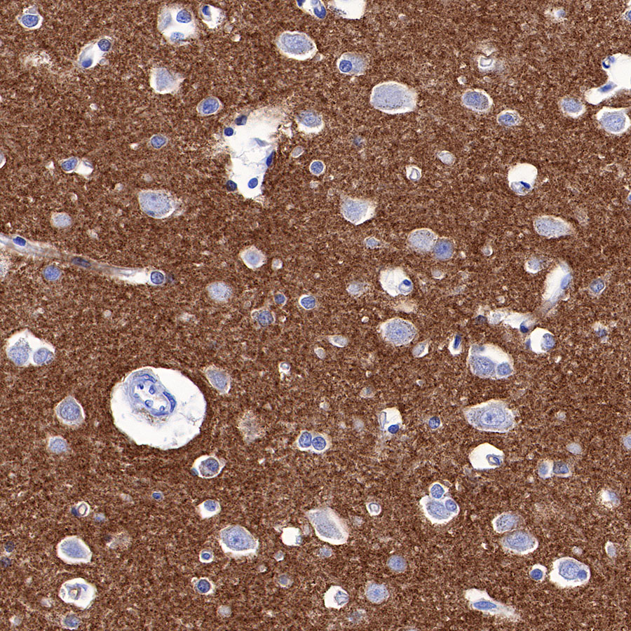 Rabbit anti-α-Synuclein Recombinant Monoclonal Antibody(S-441-86)