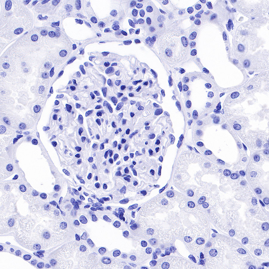 Rabbit anti-Arginase-1 Recombinant Monoclonal Antibody(369-33)