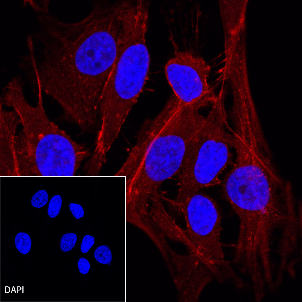 Rabbit anti-β-Actin Recombinant Monoclonal Antibody(AF594 Conjugate)(S-R156)
