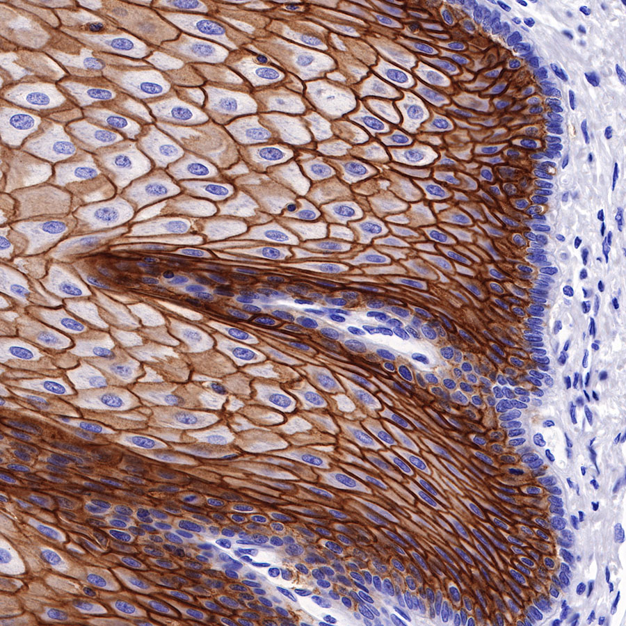 Rabbit anti-TACSTD2 Recombinant Monoclonal Antibody(S-R237)