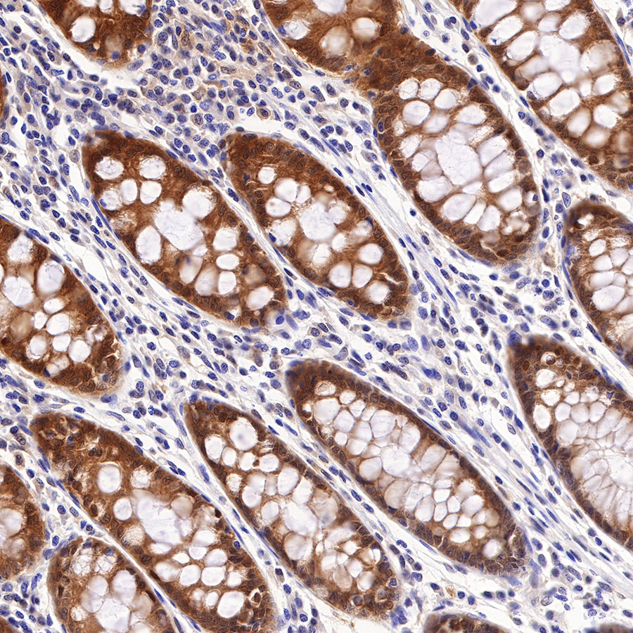 Rabbit anti-Caspase-7 Recombinant Monoclonal Antibody(S-R254)