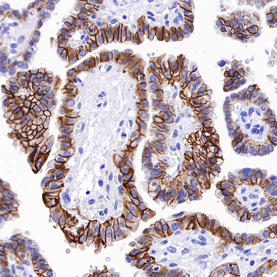 Rabbit anti-TACSTD2 Recombinant Monoclonal Antibody(S-R237)