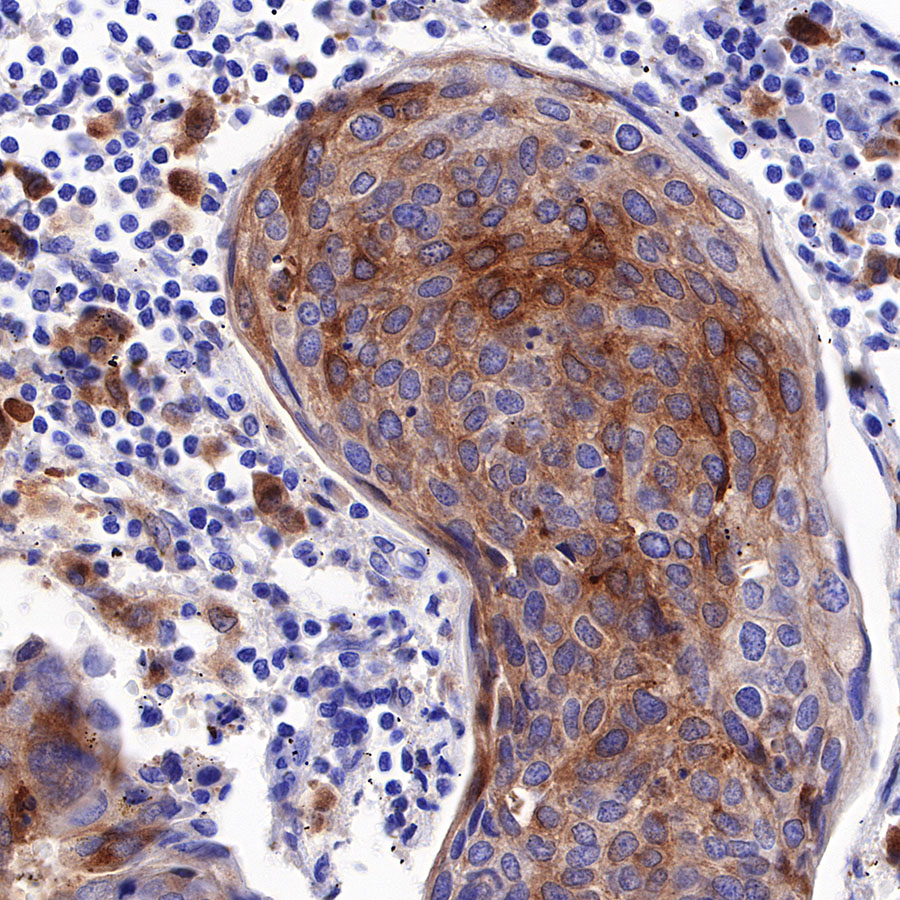 Rabbit anti-GPNMB Recombinant Monoclonal Antibody(S-R241)