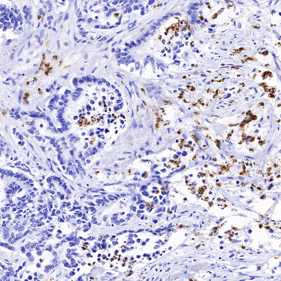 Rabbit anti-Arginase-1 Recombinant Monoclonal Antibody(369-33)