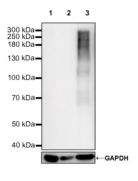 Rabbit anti-CA125 Recombinant Monoclonal Antibody(555-41)