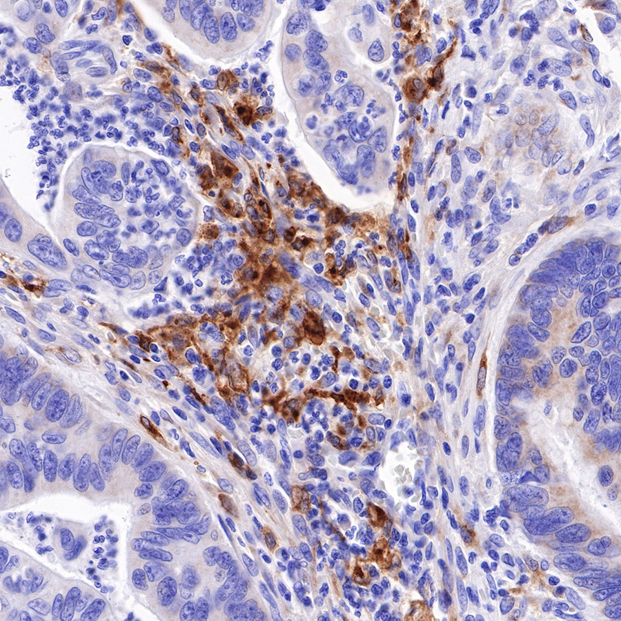 Rabbit anti-GPNMB Recombinant Monoclonal Antibody(S-R241)