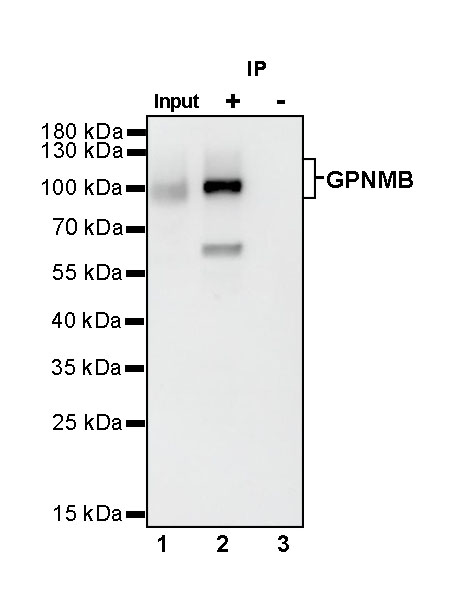 Rabbit anti-GPNMB Recombinant Monoclonal Antibody(S-R241)